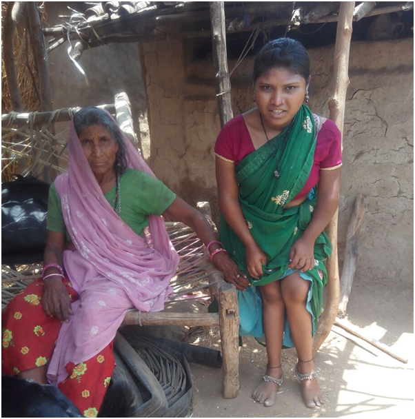 Seema Kalu, suffering from skeletal fluorosis (Source:Dalpat & Heena)